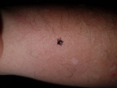 Rhipicephalus evertsi