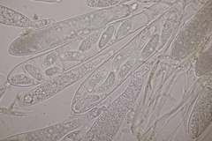 Pezicula acericola