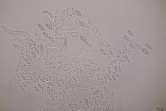 Dialonectria episphaeria