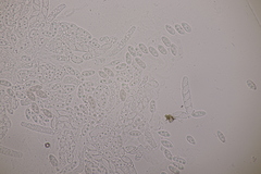 Dialonectria episphaeria