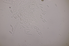 Dialonectria episphaeria