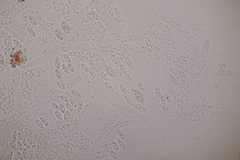 Dialonectria episphaeria