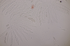 Dialonectria episphaeria