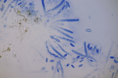 Dialonectria episphaeria