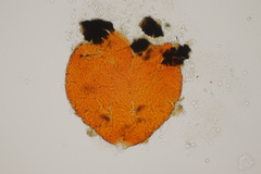 Dialonectria episphaeria