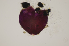 Dialonectria episphaeria