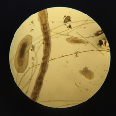Macrostomum