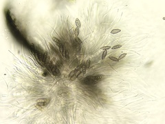 Eopyrenula intermedia