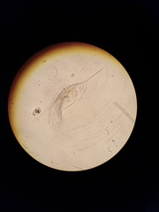 Kellicottia bostoniensis