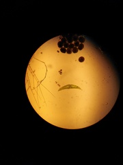 Closterium moniliferum