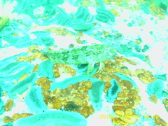 Clinus superciliosus