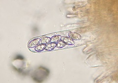 Octospora leucoloma