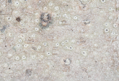 Pertusaria pustulata