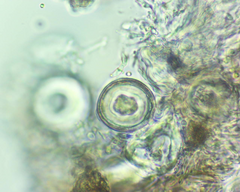 Pertusaria pustulata