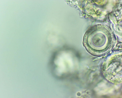 Pertusaria pustulata