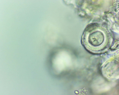 Pertusaria pustulata