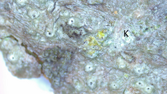 Pertusaria pustulata