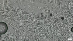 Hypocreaceae