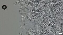 Hypocreaceae
