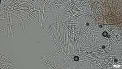 Hypocreaceae