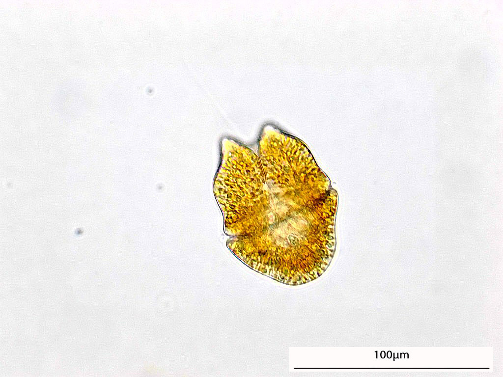 dinoflagellates and allies