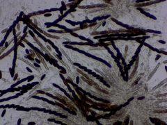 Rosellinia