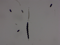 Rosellinia