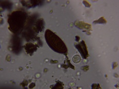 Hypoxylon perforatum