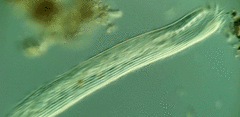 Condylostomum patulum