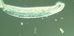 Condylostomum patulum