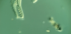 Condylostomum patulum