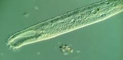 Condylostomum patulum
