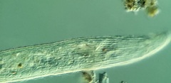 Condylostomum patulum