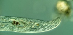 Condylostomum patulum
