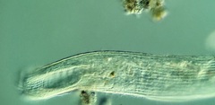 Condylostomum patulum
