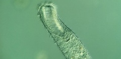 Condylostomum patulum