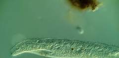 Condylostomum patulum