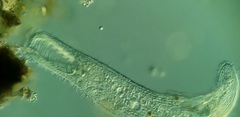 Condylostomum patulum