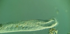 Condylostomum patulum