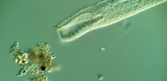 Condylostomum patulum