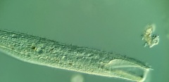 Condylostomum patulum