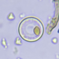 Coscinodiscophycidae