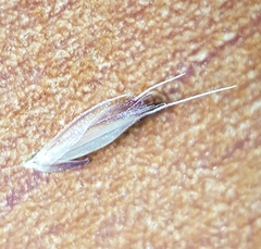 Chloris
