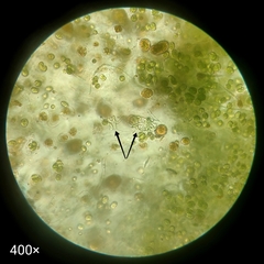 Cyanobacteria