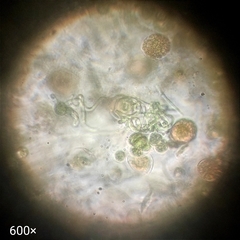 Cyanobacteria