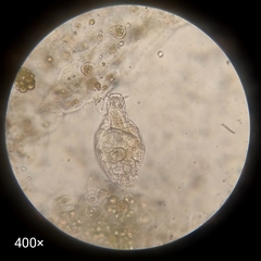 Bdelloidea