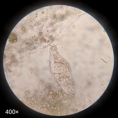 Bdelloidea