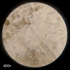 Bdelloidea