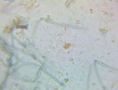 Byssocorticium atrovirens