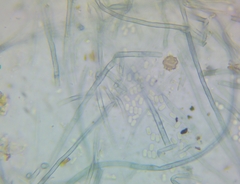 Byssocorticium atrovirens
